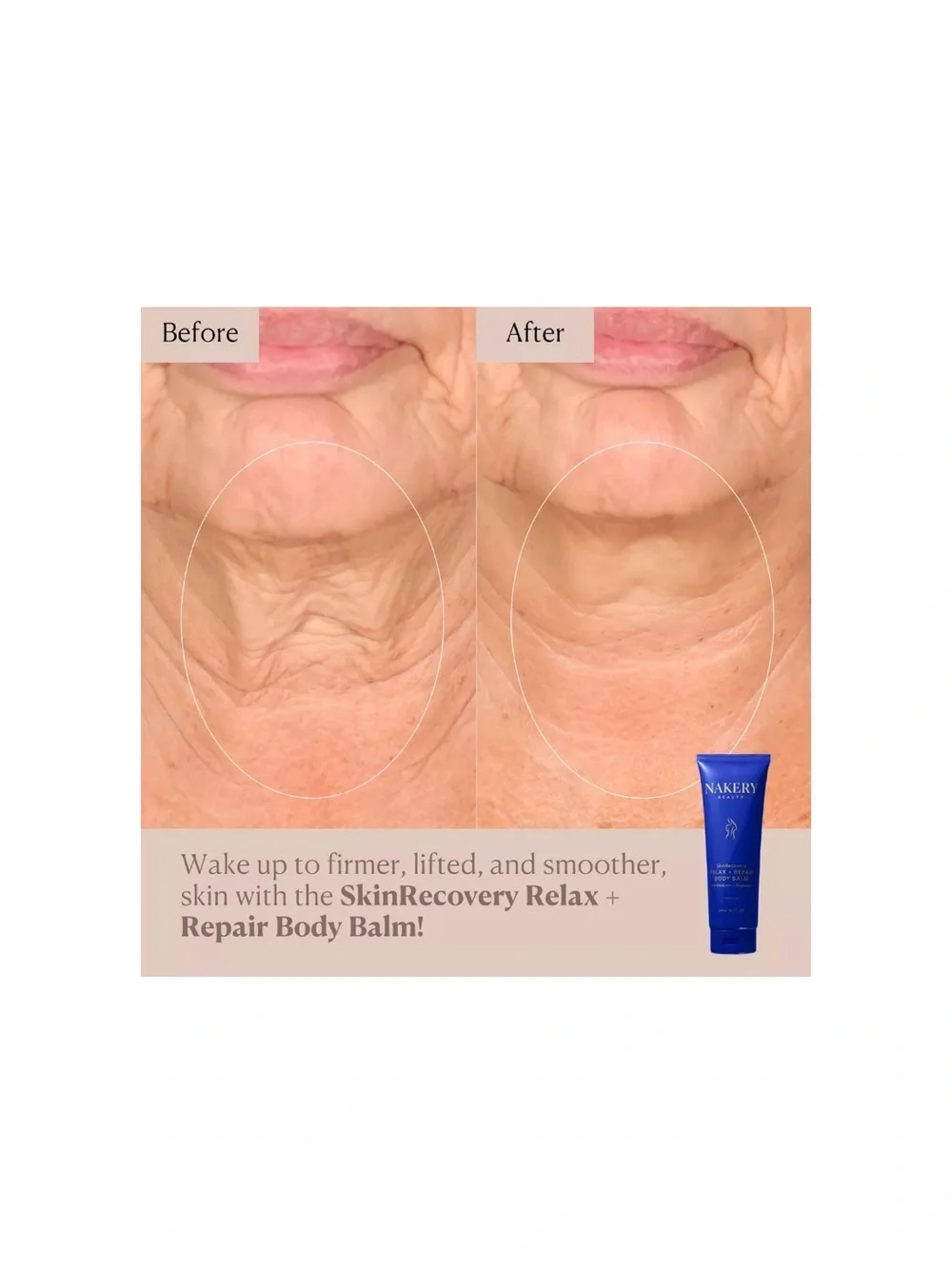 Nakery SkinRecovery Relax + Repair Body Balm - Picture 3 of 4